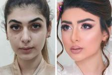 تصویر بند انگشتی قبل و بعد
